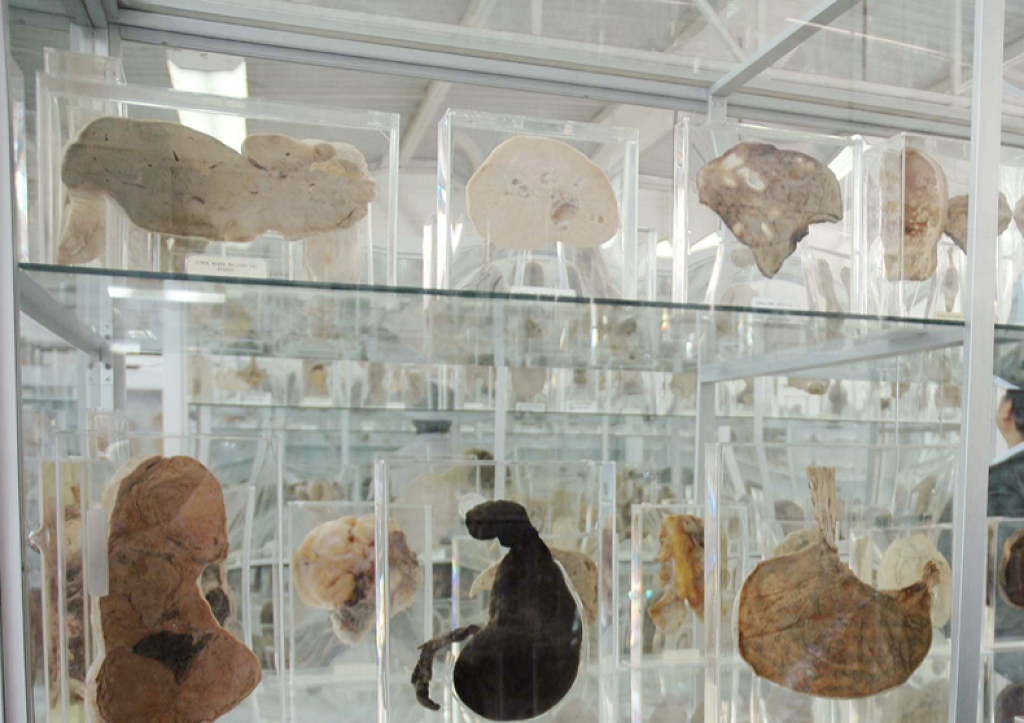 Museo de Patología Hospital General de México Eduardo Liceaga-0