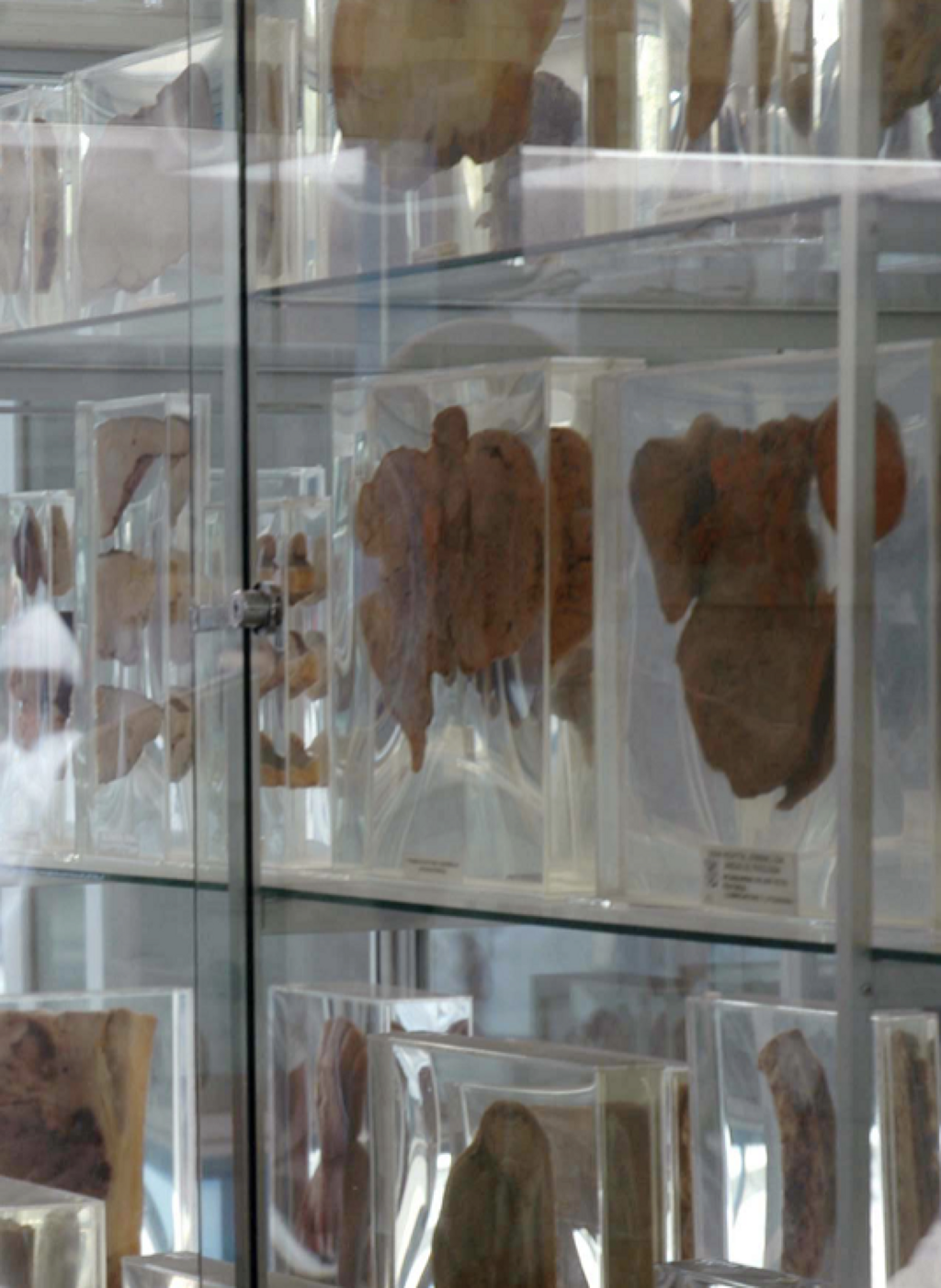 Museo de Patología Hospital General de México Eduardo Liceaga-1