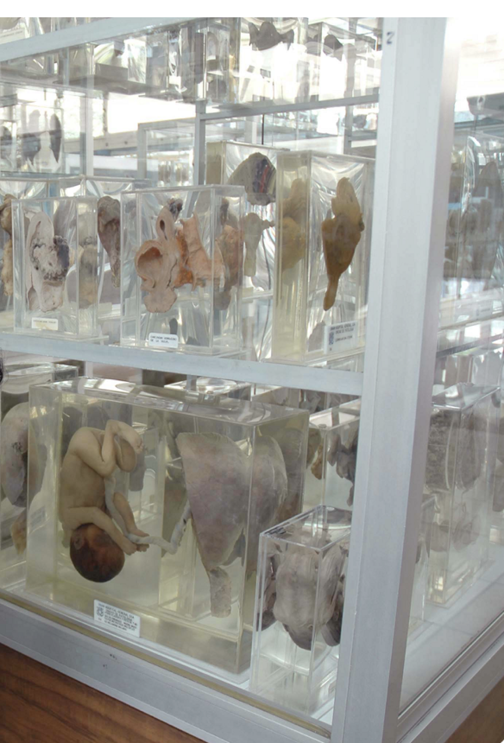 Museo de Patología Hospital General de México Eduardo Liceaga-2